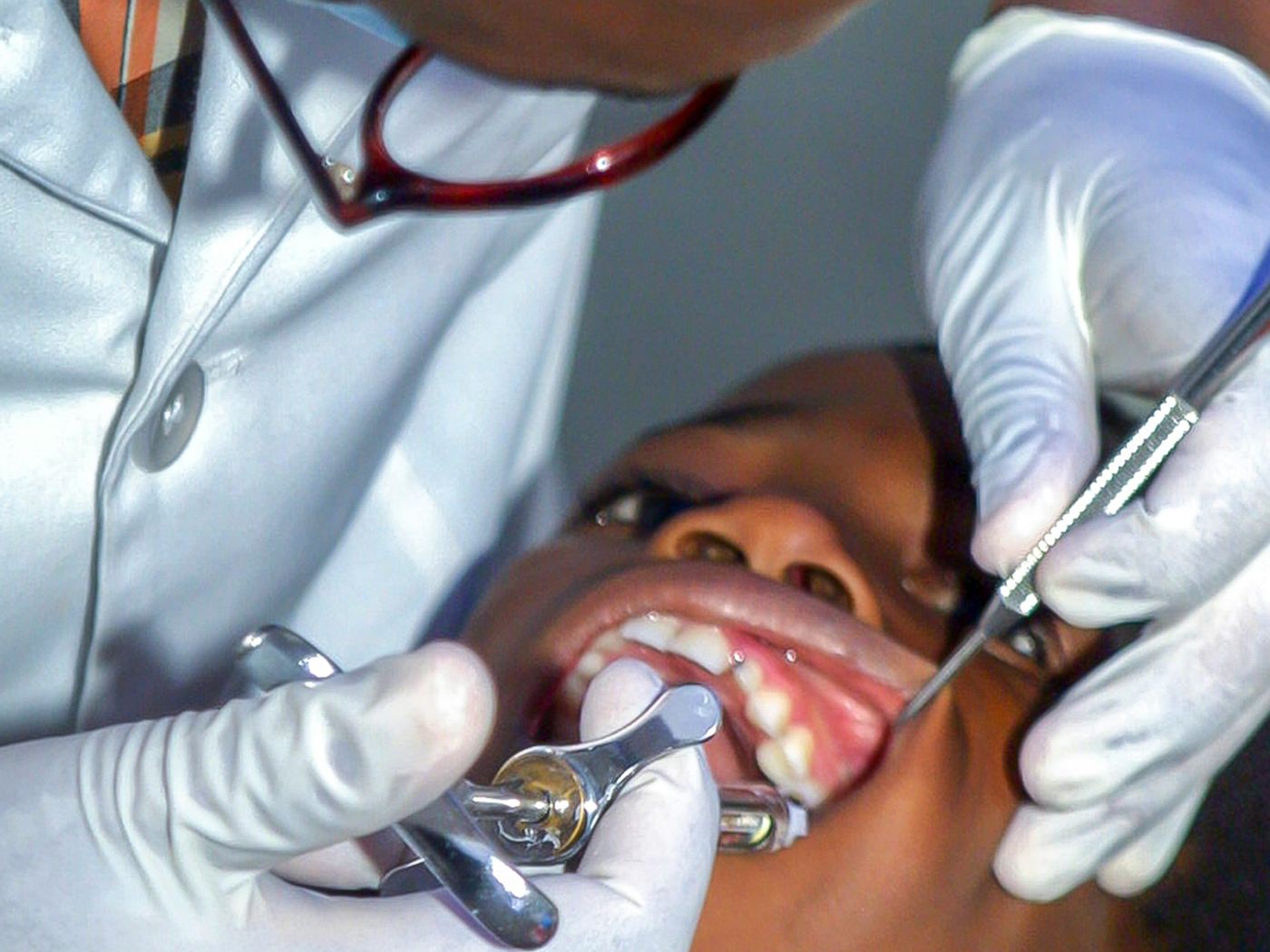 A Glaze dentist examining a young patient gently, explaining as they go